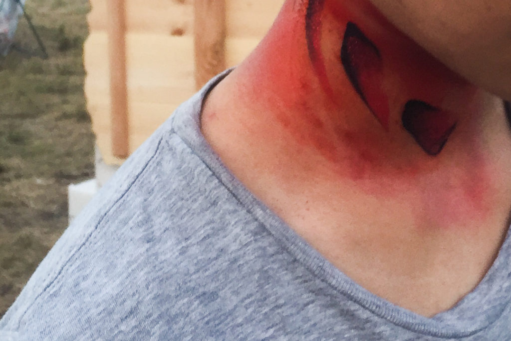 さめに噛まれちゃったよ！